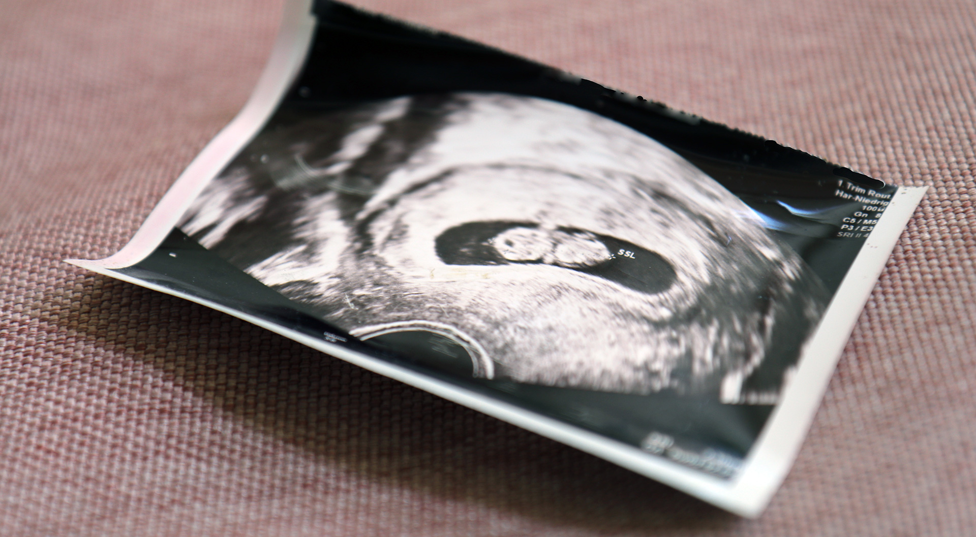 Siebte schwangerschaftswoche ultraschall